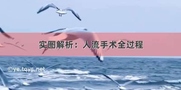 实图解析：人流手术全过程