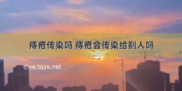 痔疮传染吗 痔疮会传染给别人吗