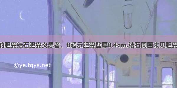 现一无症状的胆囊结石胆囊炎患者。B超示胆囊壁厚0.4cm.结石周围未见胆囊腔 胆囊肿胀